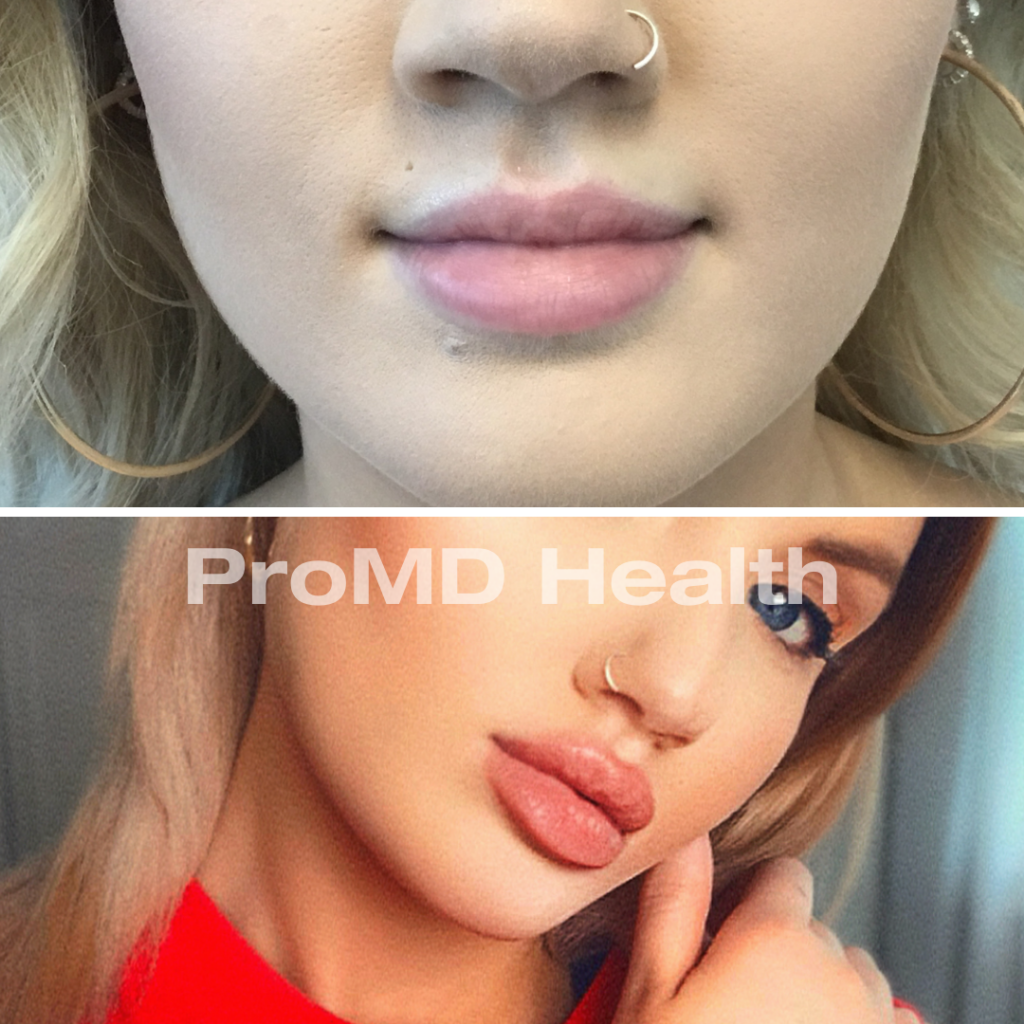 lips
