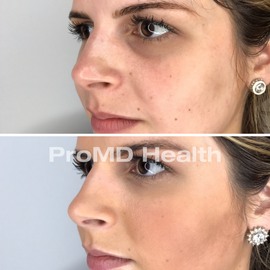 Panfacial