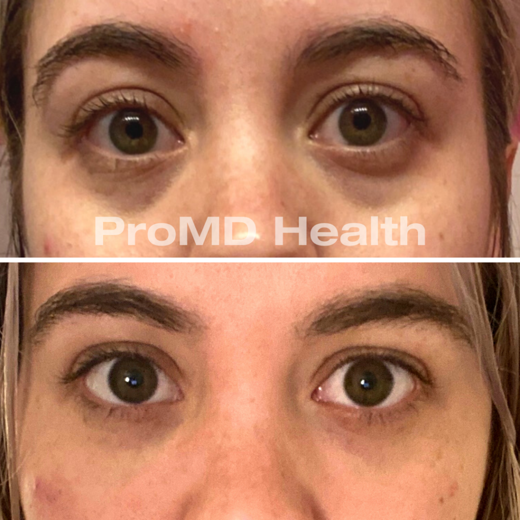 Panfacial
