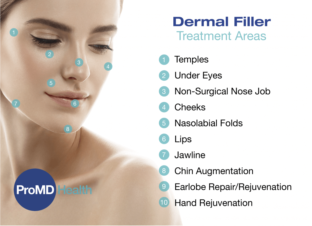 FillerTxAreas