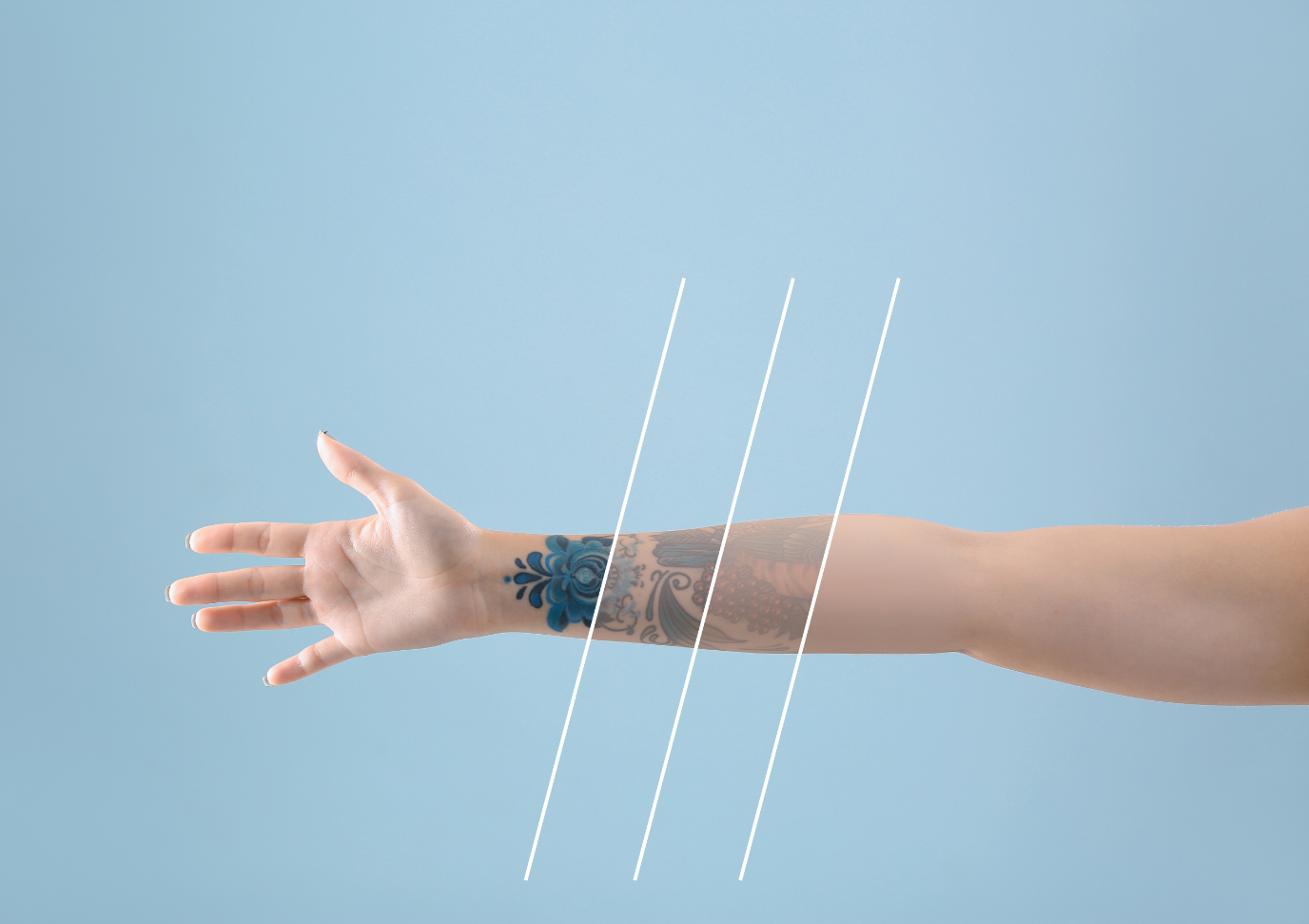Tattoo Removal at ProMD Health Tablet
