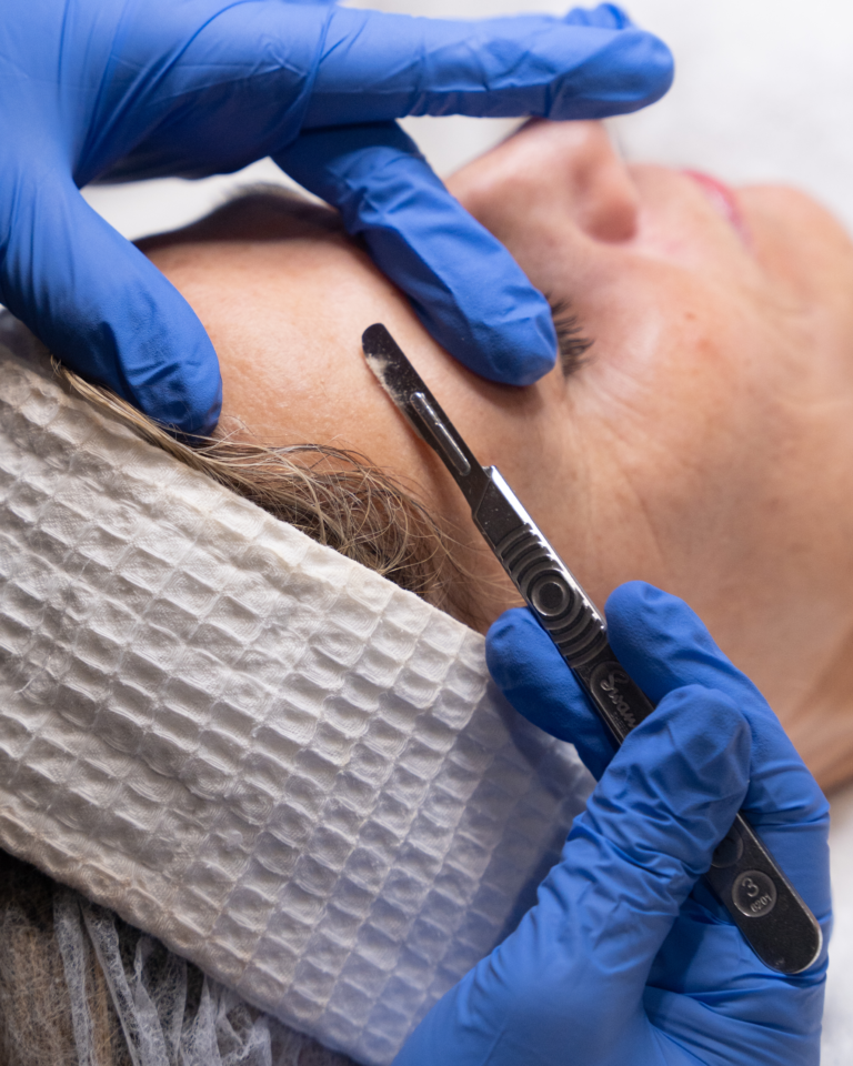 Dermaplaning
