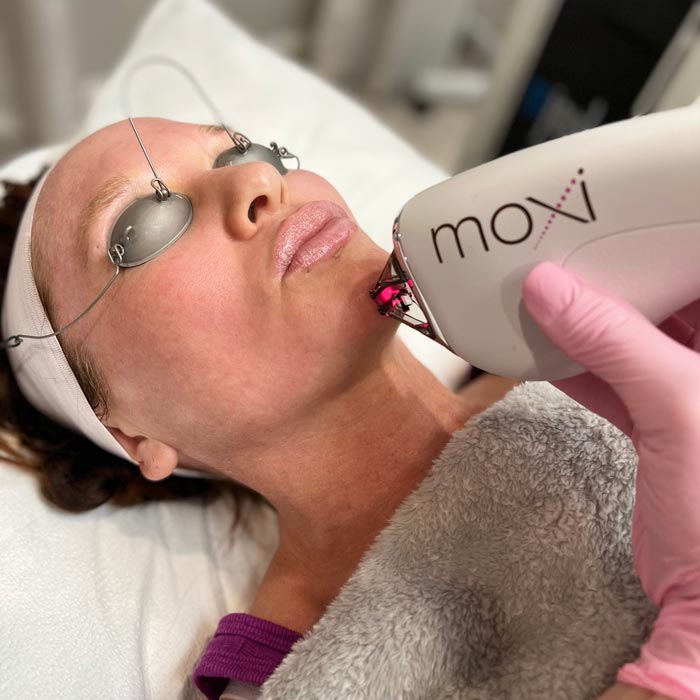 Moxi