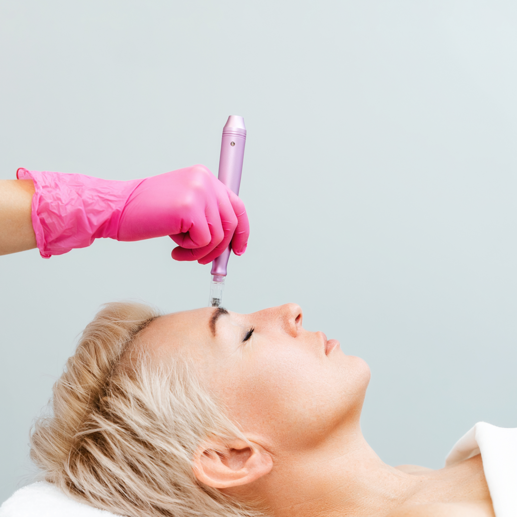 Microneedling